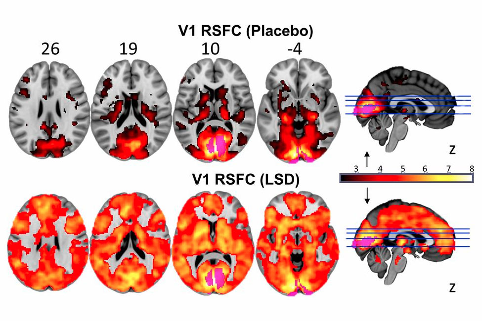 brain on acid lsd 0001 alt