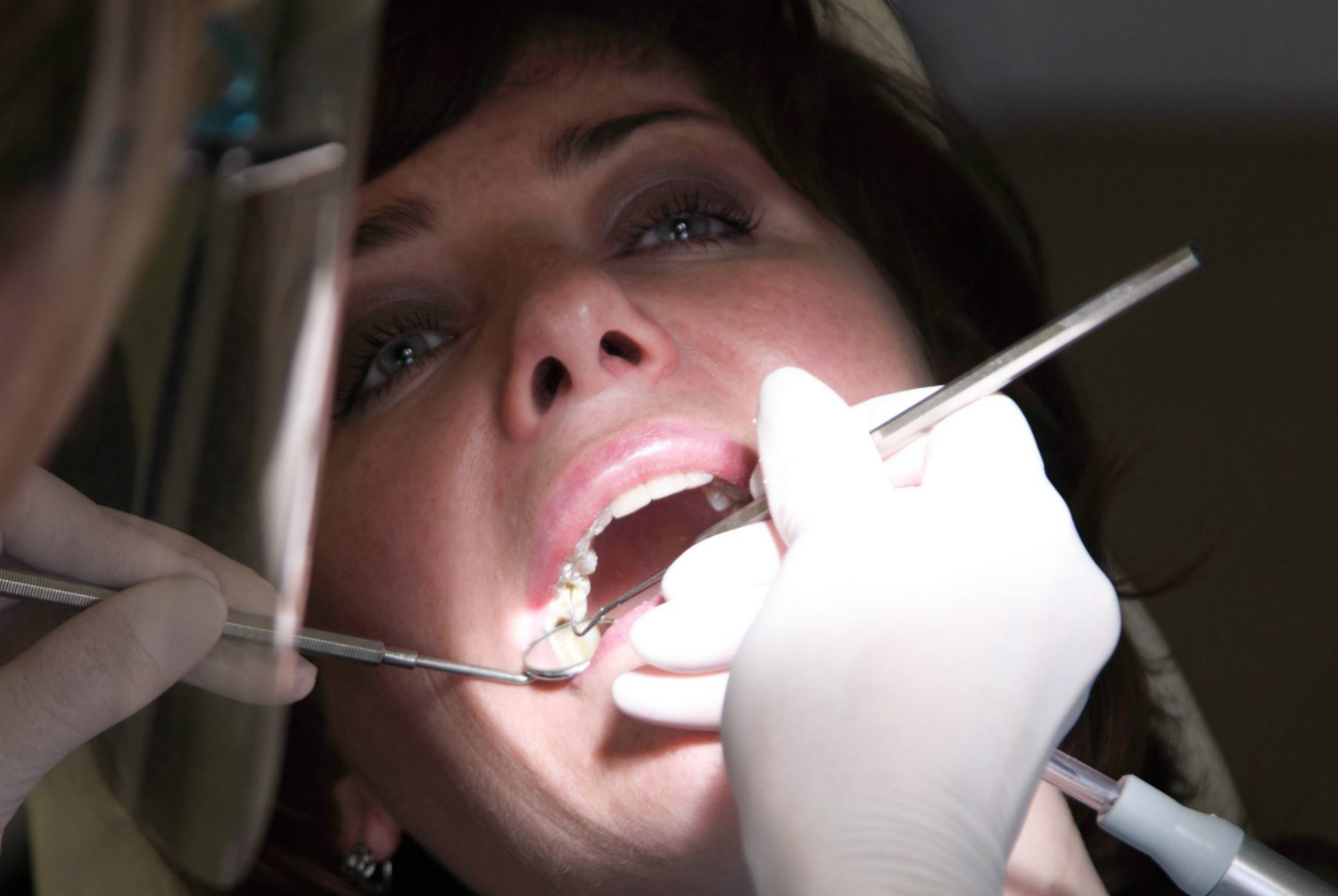 drug releasing tooth implant female patient at the dentist