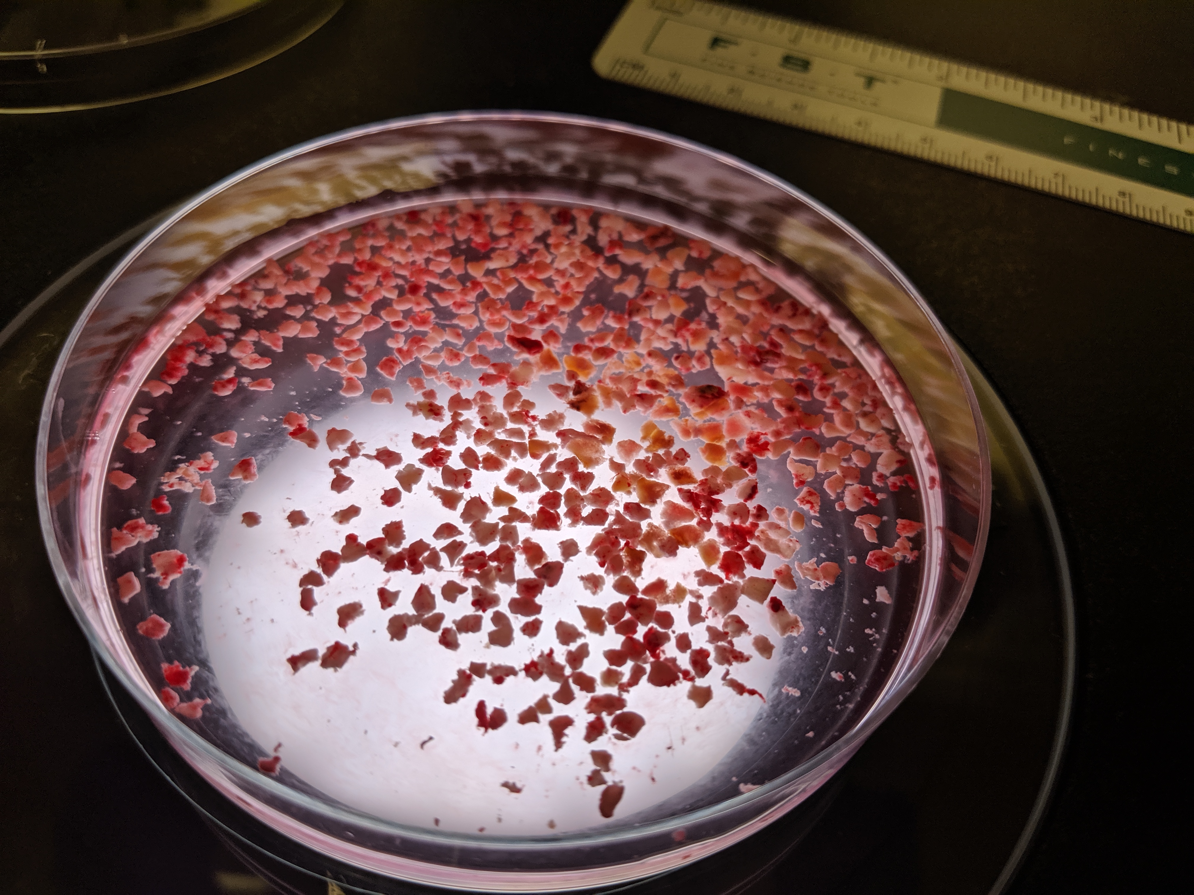 Dissected tumor pieces that will be used to grow brain organoids.